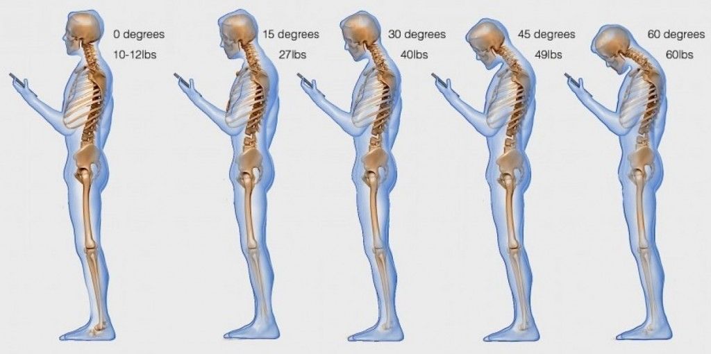 Text neck’ is becoming an ‘epidemic’ and could wreck your spine